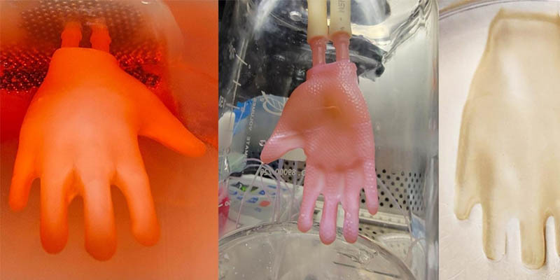 Injertos de piel creados con bioingeniería que se ajustan como un guante
