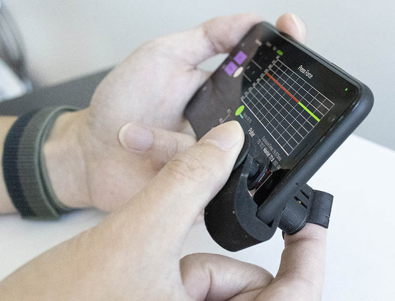 Accesorio para teléfono inteligente de muy bajo costo lleva el control de la presión arterial al alcance de su mano